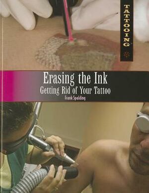 Erasing the Ink: Getting Rid of Your Tattoo by Frank Spalding