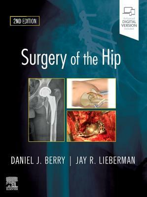 Surgery of the Hip: Expert Consult - Online and Print by Jay Lieberman, Daniel J. Berry
