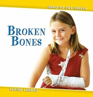 Broken Bones by Elaine Landau