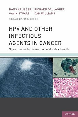 Hpv and Other Infectious Agents in Cancer: Opportunities for Prevention and Public Health by Hans Krueger, Gavin Stuart, Richard Gallagher