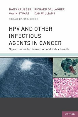 Hpv and Other Infectious Agents in Cancer: Opportunities for Prevention and Public Health by Hans Krueger, Richard Gallagher, Gavin Stuart