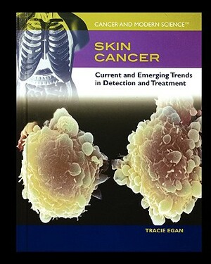 Skin Cancer: Current and Emerging Trends in Detection and Treatment by Tracie Egan
