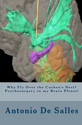 Why Fly Over the Cuckoo's Nest? Psychosurgery in my Brain Please! by Antonio de Salles