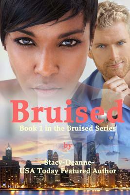 Bruised by Stacy-Deanne