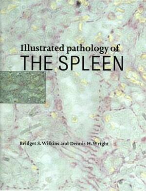 Illustrated Pathology of the Spleen by Dennis H. Wright, Bridget S. Wilkins