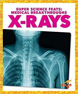 X-Rays by Alicia Klepeis