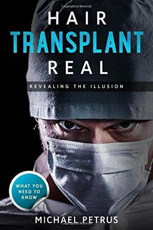 Hair Transplant Real: Revealing the Illusion by Michael Petrus