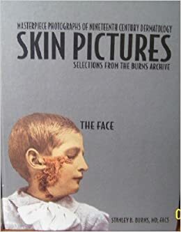 Skin Pictures: Masterpiece Photographs Of Nineteenth Century Dermatology: Selections From The Burns Archive by Stanley B. Burns