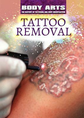 Tattoo Removal by Frank Spalding, Nicholas Faulkner