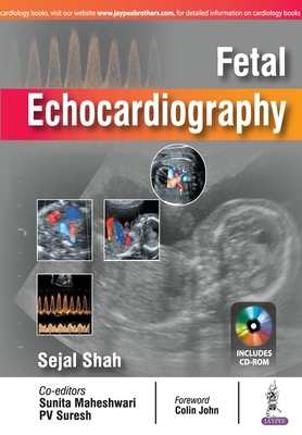 Fetal Echocardiography by Sejal Shah