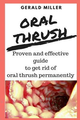 oral thrush: Premium Candida Cleanse - Yeast Infection Treatment - Oral Thrush Treatment - Organic Probiotic Support - Ultimate Cle by Gerald Miller