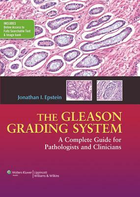The Gleason Grading System: A Complete Guide for Pathologist and Clinicians by Jonathan I. Epstein