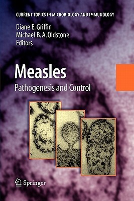 Measles: Pathogenesis and Control by 