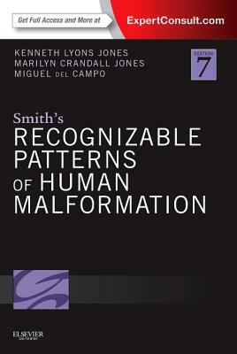 Smith's Recognizable Patterns of Human Malformation: Expert Consult - Online and Print by Miguel del Campo, Marilyn Crandall Jones, Kenneth Lyons Jones