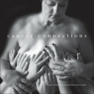 Cancer Connections: Images of Hope and Courage Across Canada by James Burns