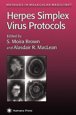 Herpes Simplex Virus Protocols by 