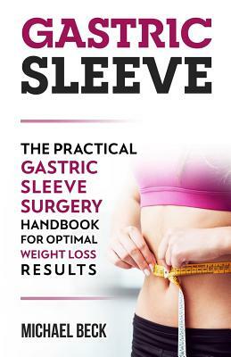 Gastric Sleeve: The Practical Gastric Sleeve Surgery Handbook for Optimal Weight Loss Results by Michael Beck