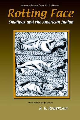 Rotting Face: Smallpox and the American Indian by R. G. Robertson, Roland G. Robertson