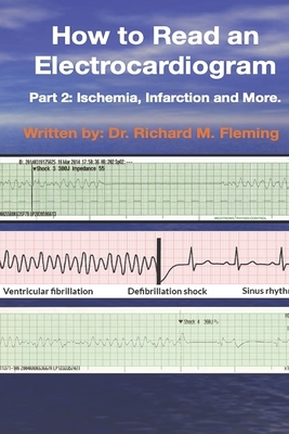 How to Read an Electrocardiogram: Part 2: Ischemia, Infarction and More. by Richard M. Fleming