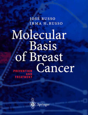 Molecular Basis of Breast Cancer: Prevention and Treatment by Irma H. Russo, Jose Russo