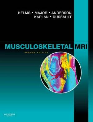 Musculoskeletal MRI by Nancy M. Major, Clyde A. Helms, Mark W. Anderson