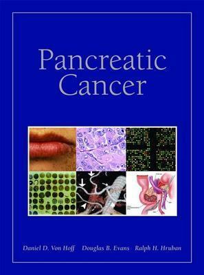 Pancreatic Cancer by Daniel Von Hoff, Douglas B. Evans, Ralph H. Hruban