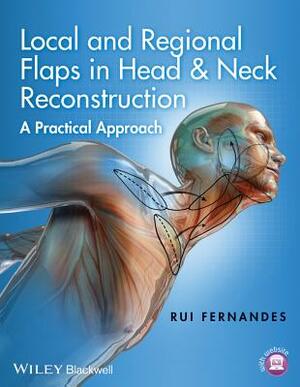 Local and Regional Flaps in Head and Neck Reconstruction: A Practical Approach by Rui Fernandes