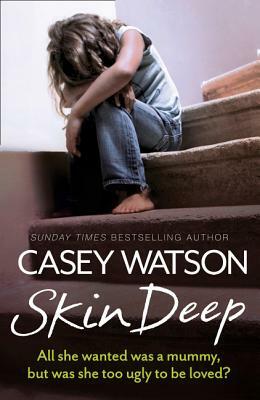 Skin Deep: All She Wanted Was a Mummy, But Was She Too Ugly to Be Loved? by Casey Watson