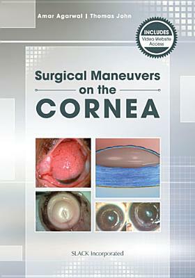 Mastering Corneal Surgery: Recent Advances and Current Techniques by Thomas John, Amar Agarwal