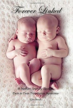 Forever Linked: A Mother's Journey Through Twin to Twin Transfusion Synrome by Erin Bruch