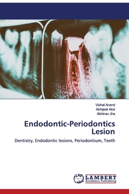 Endodontic-Periodontics Lesion by Abhinav Jha, Abhijeet Alok, Vishal Anand