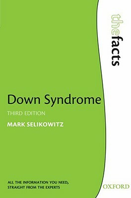 Down Syndrome by Mark Selikowitz