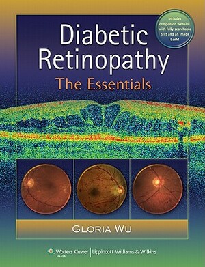 Diabetic Retinopathy: The Essentials by Gloria Wu