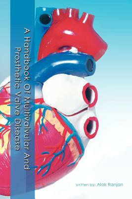 A Handbook of Multivalvular and Prosthetic Valve Disease by Alok Ranjan