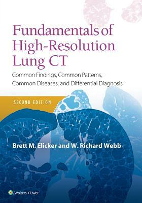 Fundamentals of High-Resolution Lung CT: Common Findings, Common Patterns, Common Diseases and Differential Diagnosis by Brett M. Elicker, W. Richard Webb