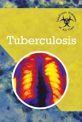 Tuberculosis by Randall McPartland