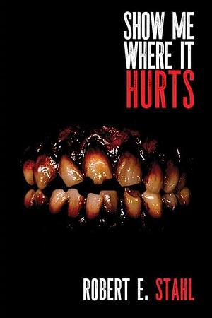Show Me Where it Hurts by Robert E. Stahl
