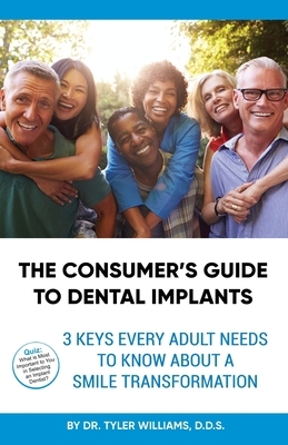 The Consumer's Guide to Dental Implants: 3 Keys Every Adult Needs to Know About A Smile Transformation by Tyler Williams