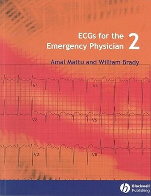 ECGs for the Emergency Physician 2 by Amal Mattu, William J. Brady