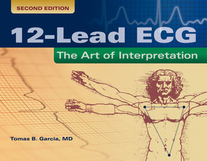 12-Lead Ecg: The Art of Interpretation by Tomas B. Garcia