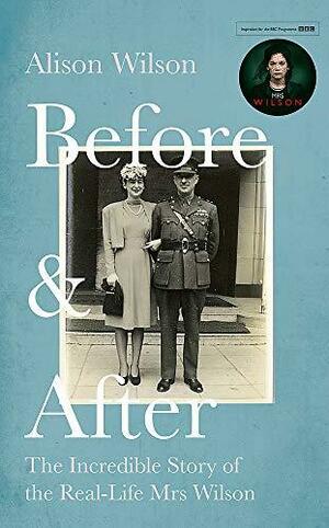 Before & After: The Incredible Story of the Real-life Mrs Wilson by Ruth Wilson, Nigel Wilson, Alison Wilson