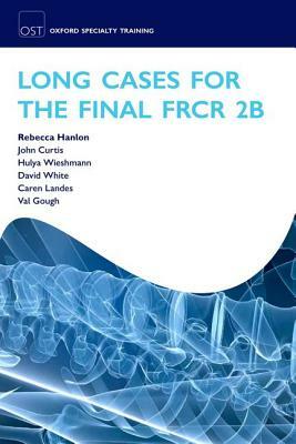 Long Cases for the Final Frcr 2b by John Curtis, Hulya Wieshmann, Rebecca Hanlon
