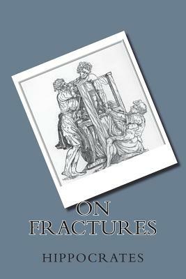 On Fractures by Hippocrates