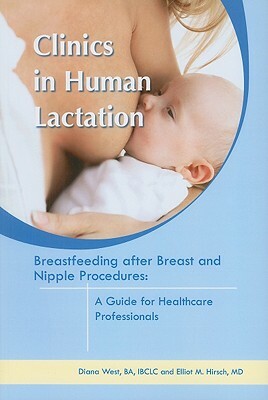 Breastfeeding After Breast and Nipple Procedures: A Guide for Healthcare Professionals by Elliot M. Hirsch, Diana West