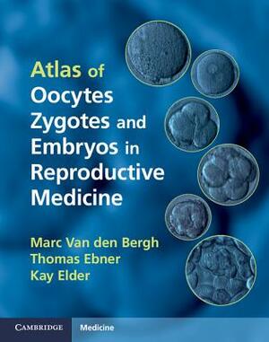 Atlas of Oocytes, Zygotes and Embryos in Reproductive Medicine Hardback [With CDROM] by Kay Elder, Marc Van Den Bergh, Thomas Ebner