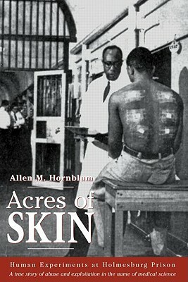 Acres of Skin: Human Experiments at Holmesburg Prison by Allen M. Hornblum