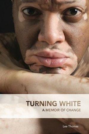 Turning White by Lee Thomas, Lee Thomas