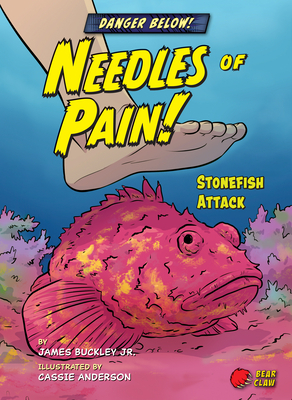 Needles of Pain!: Stonefish Attack by James Jr. Buckley