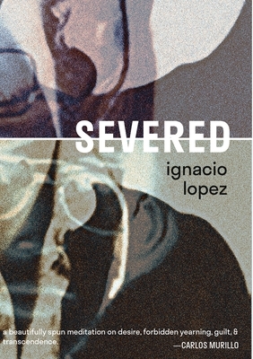 Severed by Ignacio Lopez