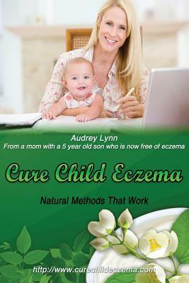 Cure Child Eczema: Natural Methods That Work by Audrey Lynn